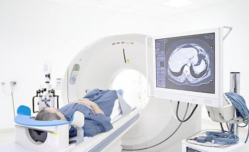 第一類醫療器械經營 無需備案，但需合規